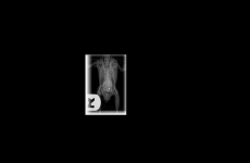 Kiwi XRay.png